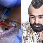 fotó Tetoválás a szemgolyón 2018.02.13 -tól №084 - Szemgolyó tetoválás -