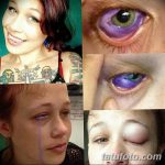 fotó Tetoválás a szemgolyón 2018.02.13 -tól №076 - Szemgolyó tetoválás -