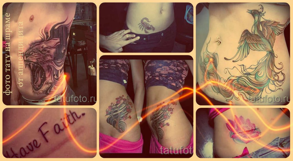 Татуировка върху белег от снимка на апендицит - интересни опции за рисунки в готовата татуировка