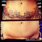 снимка Татуировка върху белег от цезарово сечение от 23.09.2017 г. No 003 - Цезарово сечение -