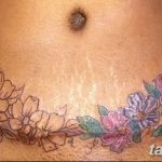 снимка Татуировка върху белег от цезарово сечение от 23.09.2017 г. No 006 - Цезарово сечение -