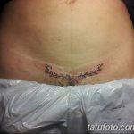 снимка Татуировка върху белег от цезарово сечение от 23.09.2017 г. No 016 - Цезарово сечение -