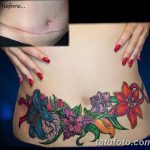 снимка Татуировка върху белег от цезарово сечение от 23.09.2017 г. No 020 - Цезарово сечение -