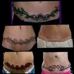 снимка Татуировка върху белег от цезарово сечение от 23.09.2017 г. No 021 - Цезарово сечение -