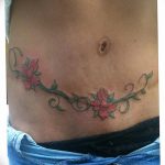 снимка Татуировка на белег от цезарово сечение от 23.09.2017 г. №030 - Цезарово сечение -