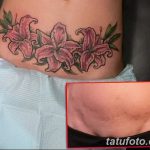 снимка Татуировка върху белег от цезарово сечение от 23.09.2017 г. No 040 - Цезарово сечение -