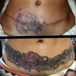 снимка Татуировка върху белег от цезарово сечение от 23.09.2017 г. No 050 - Цезарово сечение -