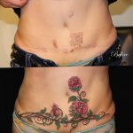 снимка Татуировка върху белег от цезарово сечение от 23.09.2017 г. No 058 - Цезарово сечение -