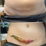 снимка Татуировка върху белег от цезарово сечение от 23.09.2017 г. No 067 - Цезарово сечение -