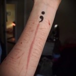 idézetek a karon - női tetoválás hegen - átfedés - fényképes idézetek a karon - női tetoválás hegen - átfedés - fotó