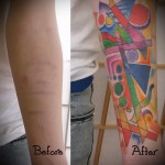 fényes figurák - női tetoválás hegen - átfedés - fotó