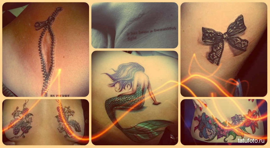 TEToválás egy heges nőre - mintafotók