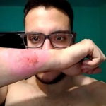 Tetovaža na ribežu - fotografija 2