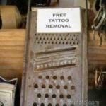 Uklanjanje tetovaža - foto primkol 1