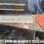 Uklanjanje tetovaža - foto primkol 5