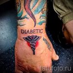 Caduceus tetoválás fotó - boldogságot és szerencsét szimbolizáló tetoválás 4204 tatufoto.ru