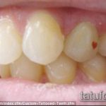 tetoválás a fogakon # 767 - a minta egyedi változata, amely jól használható felülvizsgálatra és tetoválásként történő alkalmazásra a fogakon