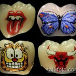 tetoválás a fogakon # 432 a minta klassz változata, amely sikeresen használható a fogakra való tetoválásként történő feldolgozásra és alkalmazásra