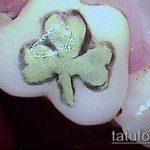 A tetoválás a fogakon # 250 egy minta méltó változata, amely sikeresen használható átalakítására és alkalmazására tetoválásként a fogakon