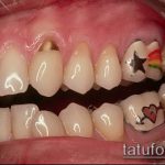 tetoválás a fogakon # 607 a minta hűvös változata, amely sikeresen használható átalakítására és tetoválásként történő alkalmazására a fogakon