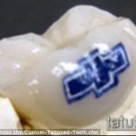tetoválás a 48. számú fogakon - a minta hűvös változata, amely sikeresen használható felülvizsgálatra és tetoválásként történő alkalmazásra a fogakon
