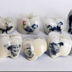 A tetoválás a fogakon # 863 a minta klassz változata, amely sikeresen használható változtatásra és tetoválásként történő alkalmazásra a fogakon