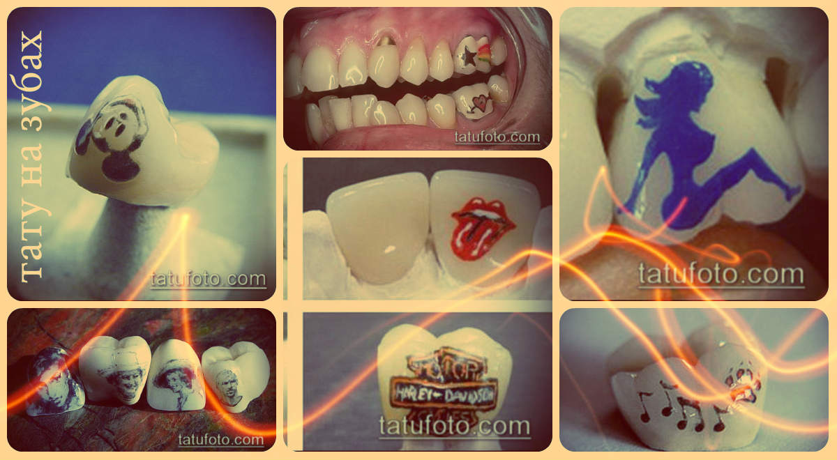 Fog tetoválás - példák a szokatlan tetoválásokra