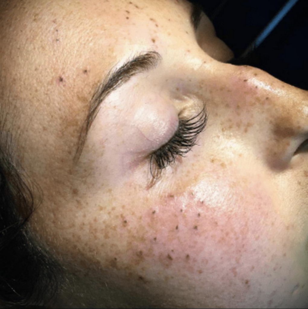 rhiannonthevegan - tetovaža pjegica na licu