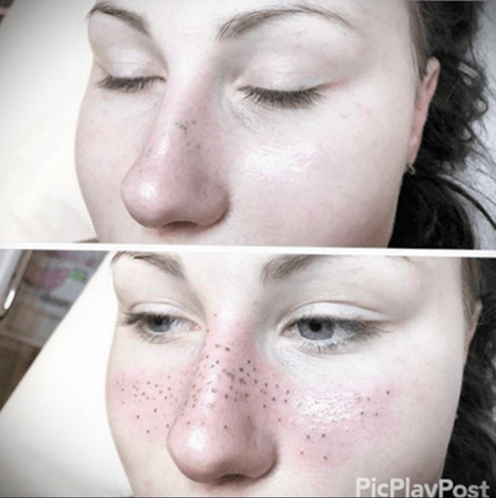 thefacestudio - fotografija tetovaže pjegica na licu