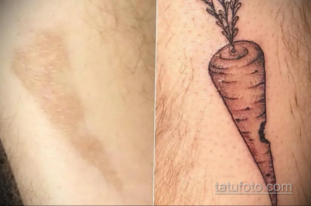 Tatuaże i blizny - zdjęcie 11