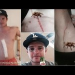 Tetoválás sebhelyeken a férfiak gyomrán 4