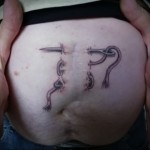 tetoválás a hegen az ember hasán 2