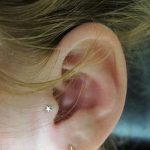 ثقب الزنمة الصورة من 19.09.2017 №035 - ثقب الزنمة -