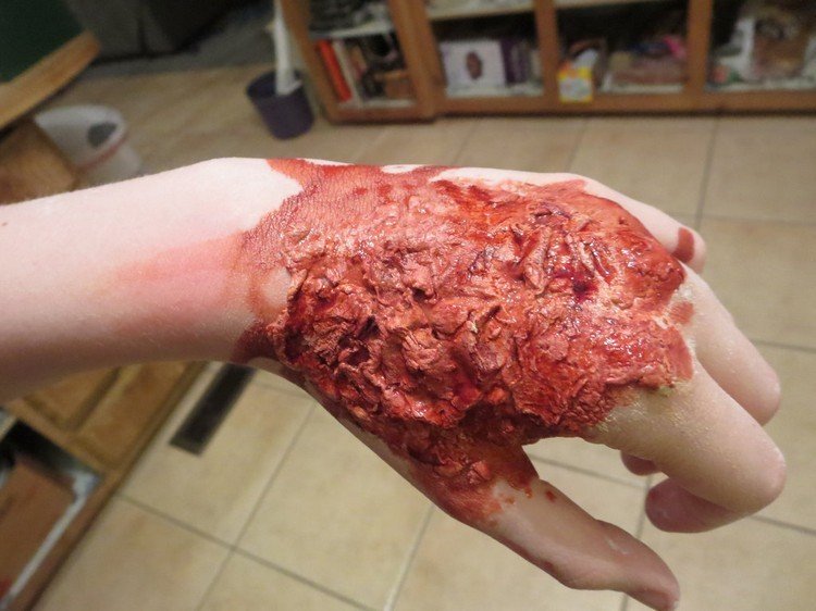 Na popáleniny zápästia naneste make-up líčidlá-make-up-popáleniny-zápästia-kuchynské-utierky-sami