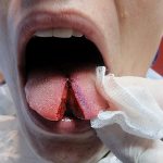 photo Snake tongue in man dated 02.02.2018 №006 - Snake tongue in man -