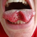 photo Snake tongue in man dated 02.02.2018 №011 - Snake tongue in man -