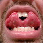 photo Snake tongue in man dated 02.02.2018 №040 - Snake tongue in man -
