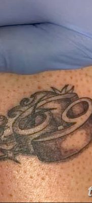 fototatovering 69 dateret 09/23/2017 №011 - tatovering 69 -