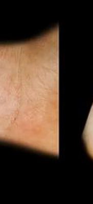 fotó eper tetoválásról (Eper tetoválás) (jelentése) - példa rajz - 015