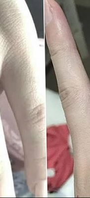صورة وشم خاتم من 23.06.2018 №329 - وشم حلقة -