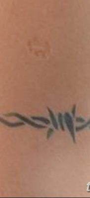 fotó szögesdrót tetoválásról, kelt 2017.07.26. 052. sz. - Szögesdrót tetoválás_