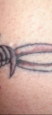 fotó szögesdrót tetoválásról, kelt 2017. 07. 26 -án, 068. sz. - Tetovált szögesdrót_