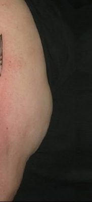 Fotó egy lándzstetoválásról 2018.08.22. №059 - lándzsás tetoválás -