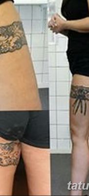 fotó egy harisnyakötő tetoválásról, kelt 2017. 03. 09 001. sz. - Harisnyakötő tetoválás -