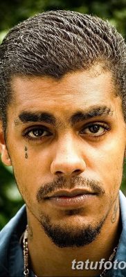 fotó egy szakadásról az arcán