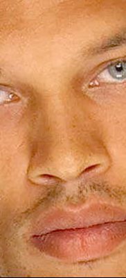 fénykép egy szakadásról az arcon