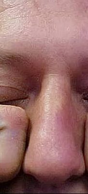 fotó egy könnycsepp tetoválásról az arcon, keltezés 2018.04.16. №048 - tetoválás szakadás az arcán -