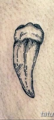 fotó egy fogtetoválásról, kelte: 2017. 09. 13. №06 - tetovált fog -