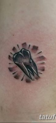 fotó egy fogtetoválásról, kelte: 2017. 09. 13. №07 - tetovált fog -