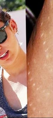 fotó egy fogtetoválásról, kelte: 09.09.2017 №098 - tetoválásfog -